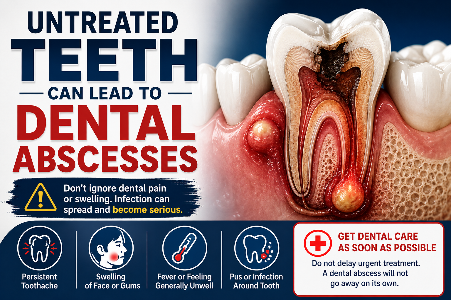 Untreated teeth can lead to dental abscesses