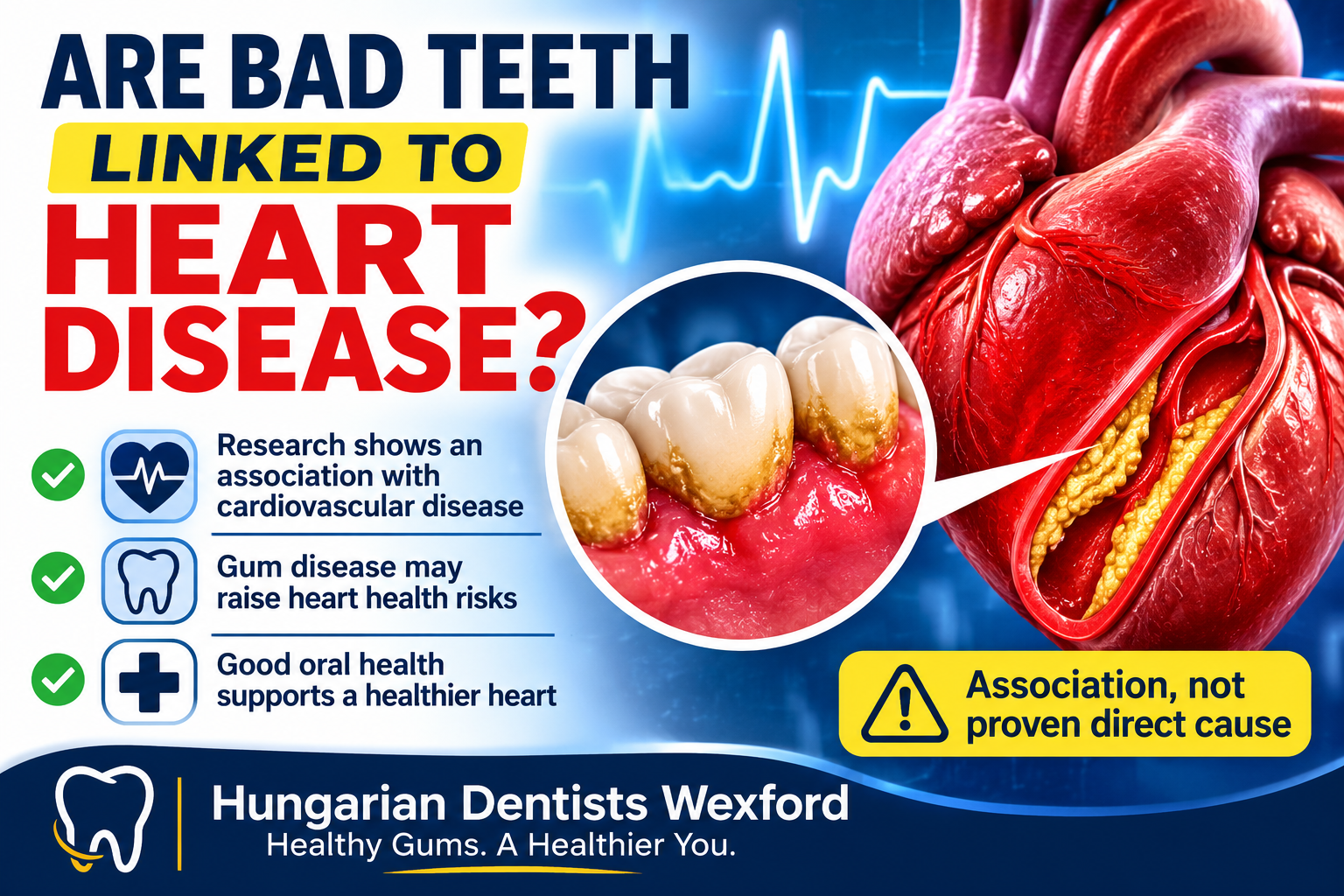 Are bad teeth linked to heart disease?