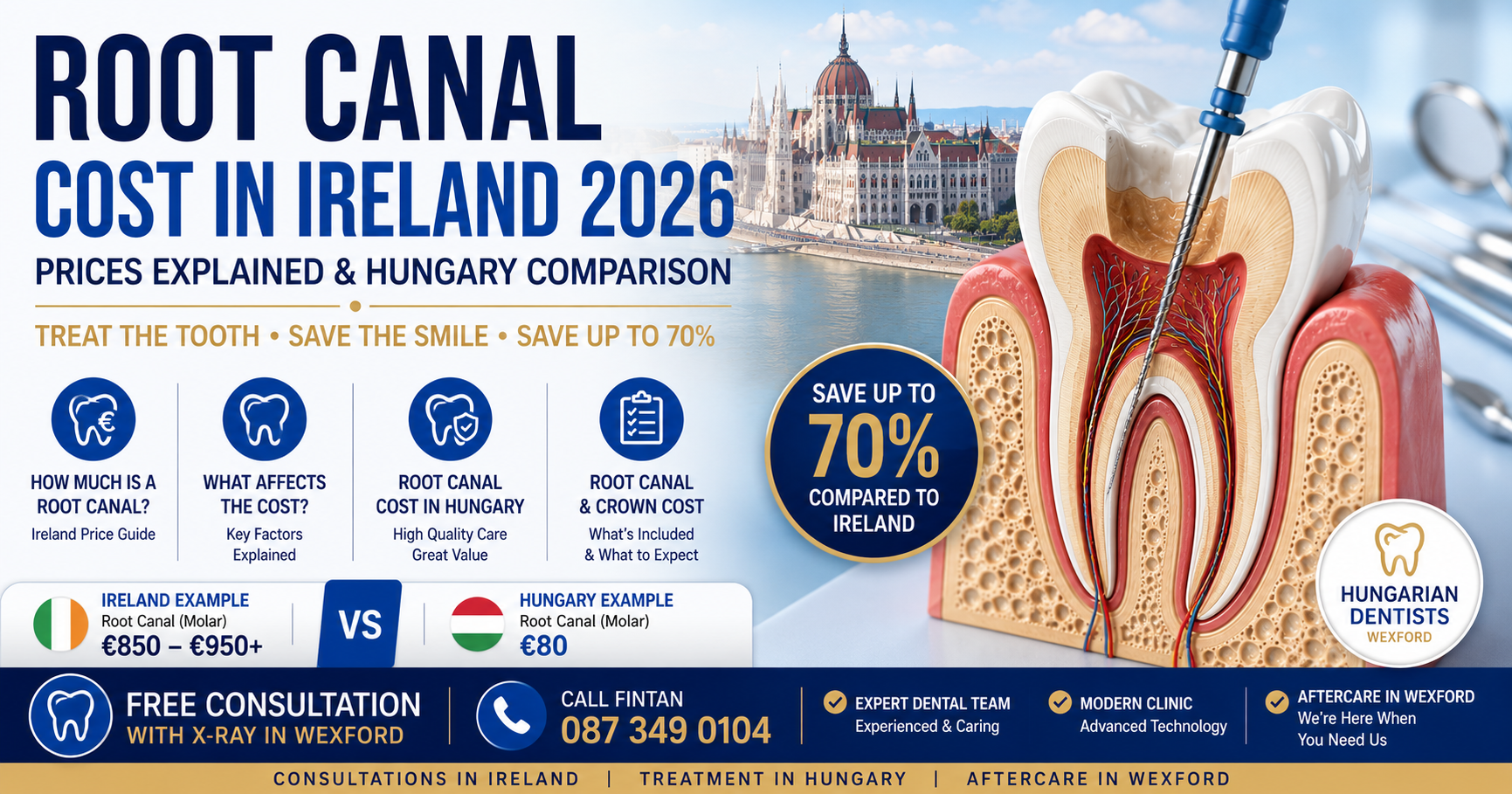 Root canal cost Ireland 2026 featured image