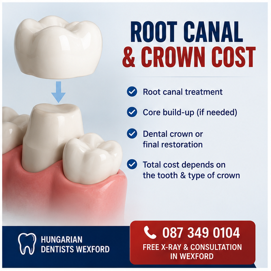 Root canal and crown cost Ireland 2026 explained