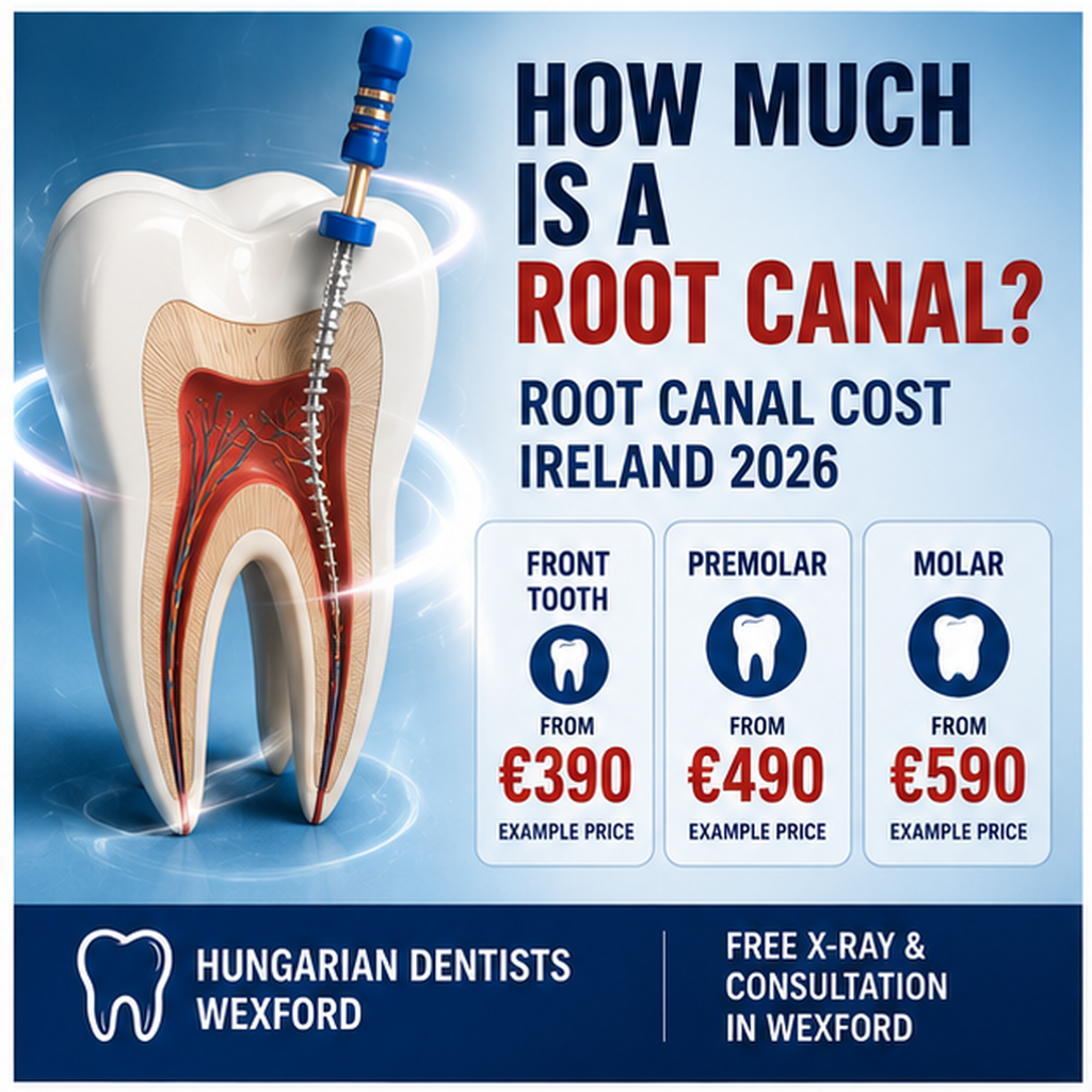 Root canal cost Ireland 2026 showing example treatment prices