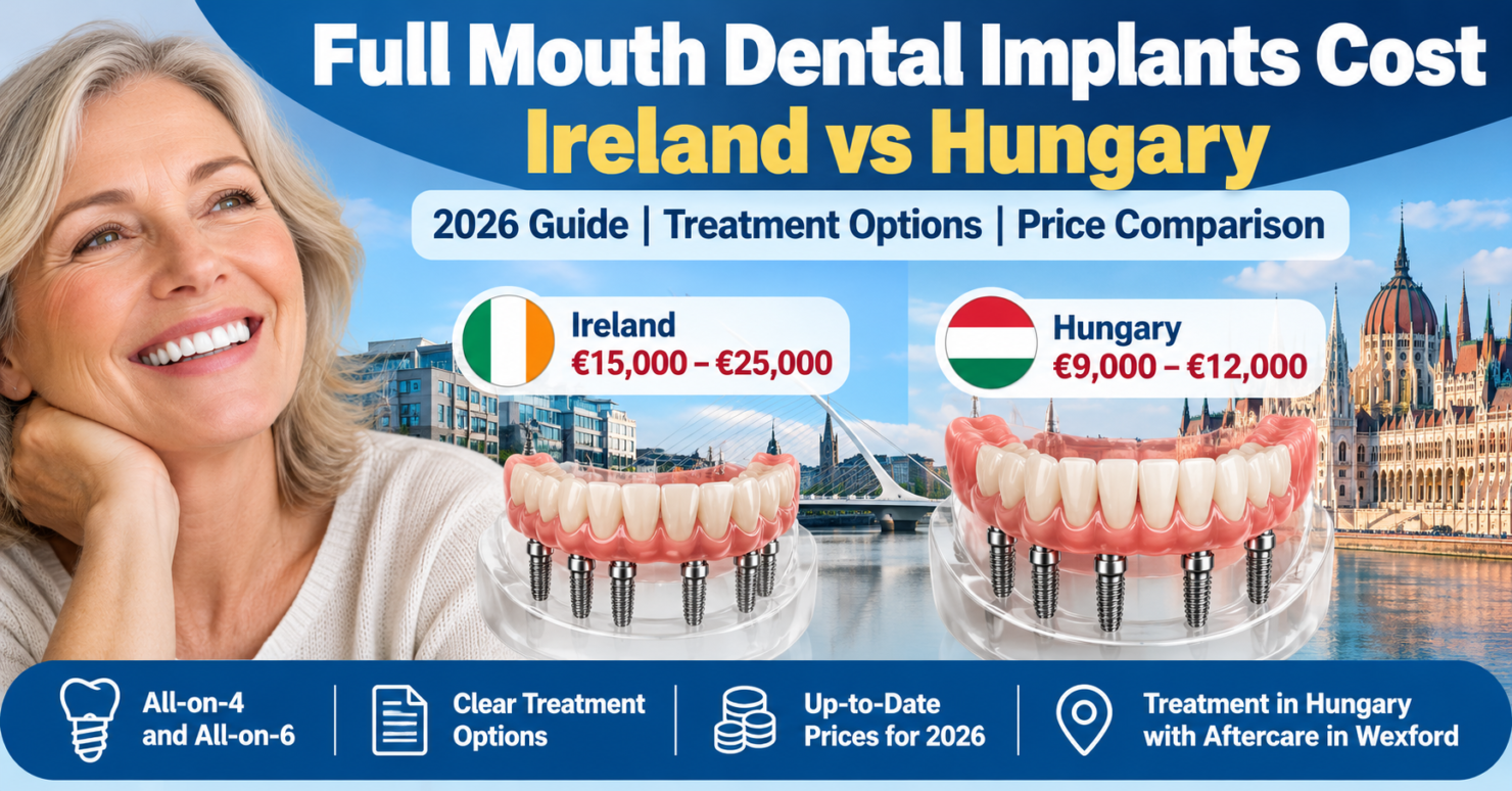 Featured image full mouth dental implants cost